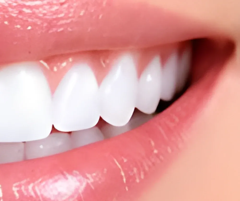 Comparação de dentes antes e depois do clareamento